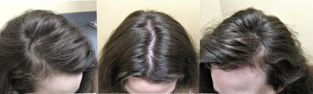 Courtney before, May 2018